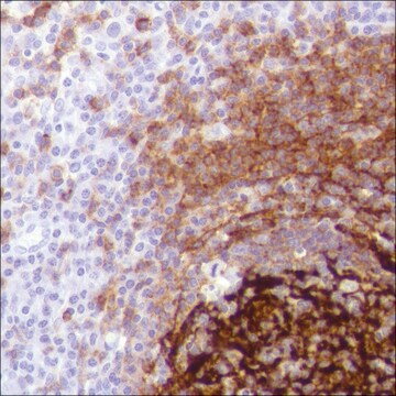 Anti-CD21 antibody, Rabbit monoclonal recombinant, expressed in proprietary host, clone SP186, affinity isolated antibody