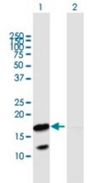 Anti-VNN3 antibody produced in mouse purified immunoglobulin, buffered aqueous solution