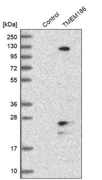 Anti-TMEM186 antibody produced in rabbit Prestige Antibodies&#174; Powered by Atlas Antibodies, affinity isolated antibody, buffered aqueous glycerol solution