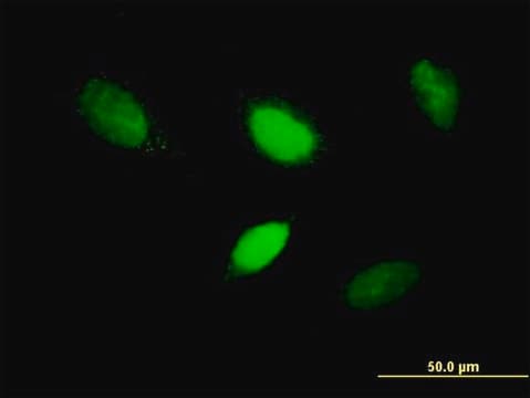 Anti-T antibody produced in mouse purified immunoglobulin, buffered aqueous solution