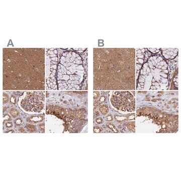 Anti-DCTN2 antibody produced in rabbit Prestige Antibodies&#174; Powered by Atlas Antibodies, affinity isolated antibody, buffered aqueous glycerol solution