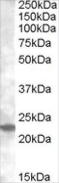 Anti-RAB17 antibody produced in goat affinity isolated antibody, buffered aqueous solution