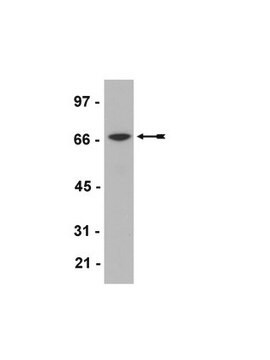 Anticorpo anticauda Myc, clone 4A6, conjugado HRP clone 4A6, Upstate&#174;, from mouse