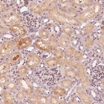 Anti-SLC34A1 antibody produced in rabbit Prestige Antibodies&#174; Powered by Atlas Antibodies, affinity isolated antibody, buffered aqueous glycerol solution