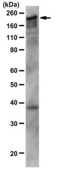 Anti-CUX1-Antikörper, Aminosäure 861 from rabbit, purified by affinity chromatography