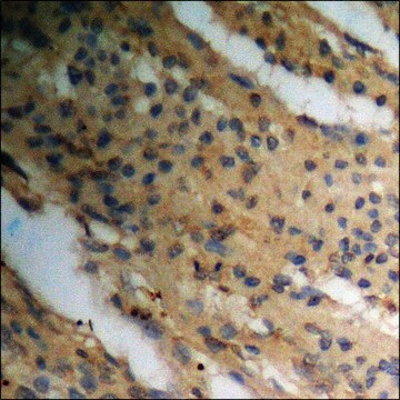 Anti-phospho-TGF &#946; Receptor II (pSer225/250) antibody produced in rabbit affinity isolated antibody