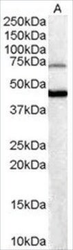 Anti-FOXG1A (BF2) and FOXG1B (BF1) antibody produced in goat affinity isolated antibody, buffered aqueous solution