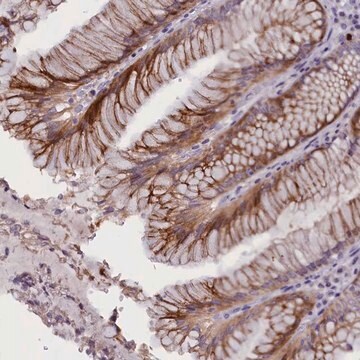 Anti-RTTN antibody produced in rabbit Prestige Antibodies&#174; Powered by Atlas Antibodies, affinity isolated antibody, buffered aqueous glycerol solution