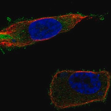 Anti-SLC27A1 antibody produced in rabbit Prestige Antibodies&#174; Powered by Atlas Antibodies, affinity isolated antibody