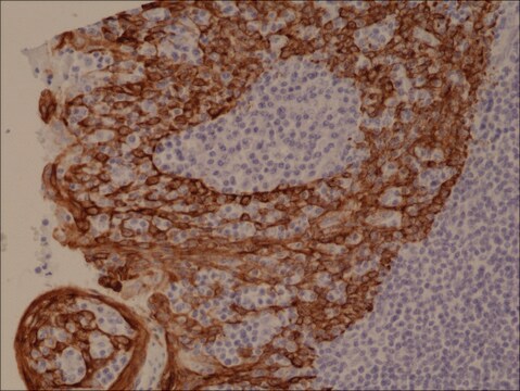 Anti-CK-5/CK-6 (Cytokeratin 5/ Cytokeratin 6) antibody, Rabbit monoclonal recombinant, expressed in HEK 293 cells, clone RM341, purified immunoglobulin