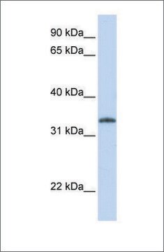 Anti-UCK2 antibody produced in rabbit affinity isolated antibody