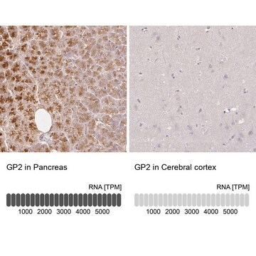 Anti-GP2 antibody produced in rabbit Prestige Antibodies&#174; Powered by Atlas Antibodies, affinity isolated antibody, buffered aqueous glycerol solution