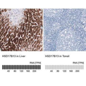 Anti-HSD17B13 antibody produced in rabbit Prestige Antibodies&#174; Powered by Atlas Antibodies, affinity isolated antibody, buffered aqueous glycerol solution