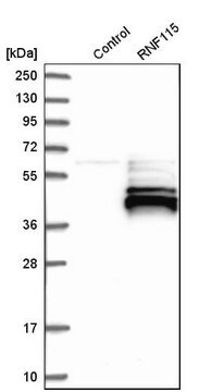 Anti-RNF115 antibody produced in rabbit Prestige Antibodies&#174; Powered by Atlas Antibodies, affinity isolated antibody, buffered aqueous glycerol solution