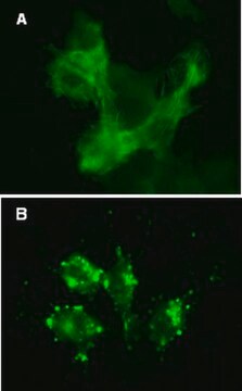 LentiBrite GFP-β-aktyna Biosensor lentiwirusowy