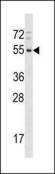 ANTI-RHD (CENTER) antibody produced in rabbit IgG fraction of antiserum, buffered aqueous solution