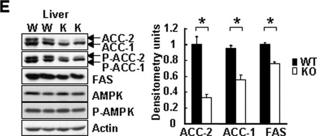 Anticuerpo anti-fosfo-acetil-CoA carboxilasa (Ser79) Upstate&#174;, from rabbit