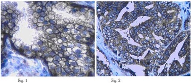 Anti-Neutral amino acid transporter (ASCT2) Antibody from rabbit, purified by affinity chromatography