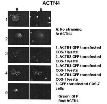 Anti-ACTN4 (AB2) antibody produced in rabbit IgG fraction of antiserum