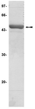 SGK1 (&#948;1-59, S422D) Protein, active, 6 &#181;g Active, N-truncated (missing N-terminal 60 amino acids), His-tagged, human SGK1 fusion protein, containing a S422D mutation, for use in Kinase Assays.