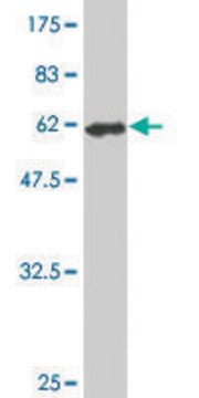 Monoclonal Anti-FVT1 antibody produced in mouse clone 2B2-3C11, purified immunoglobulin, buffered aqueous solution