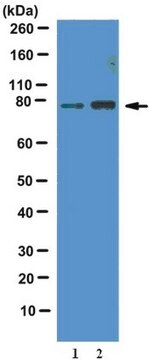 Przeciwciało anty-fosfo-FOXO1 (Thr24) from rabbit, purified by affinity chromatography