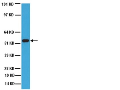 Anti-Cytochrom P450-Enzym-CYP2E1-Antikörper serum, Chemicon&#174;