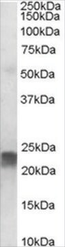 Anti-TAGLN antibody produced in goat affinity isolated antibody, buffered aqueous solution