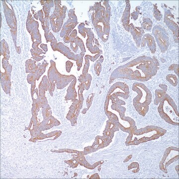 Zytokeratin 20 (Ks20.8) Mouse Monoclonal Antibody