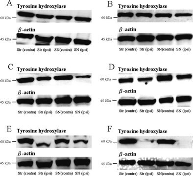 Anticuerpo anti- tirosina hidroxilasa, clon LNC1 ascites fluid, clone LNC1, Chemicon&#174;