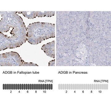 Anti-ADGB antibody produced in rabbit Prestige Antibodies&#174; Powered by Atlas Antibodies, affinity isolated antibody, buffered aqueous glycerol solution