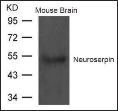 Anti-Neuroserpin antibody produced in rabbit affinity isolated antibody