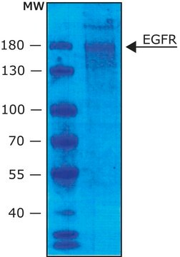 上皮増殖因子レセプター ヒト buffered aqueous glycerol solution, 5,000-30,000&#160;units/mg protein (Lowry)