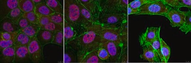 抗-PGC-1&#945; from rabbit, purified by affinity chromatography