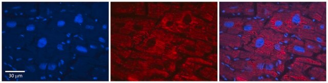 Anti-SLC33A1 antibody produced in rabbit affinity isolated antibody