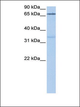 Anti-PADI2 antibody produced in rabbit affinity isolated antibody