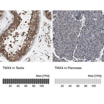 Anti-TMX4 antibody produced in rabbit Prestige Antibodies&#174; Powered by Atlas Antibodies, affinity isolated antibody, buffered aqueous glycerol solution