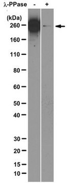 Przeciwciało przeciwko podjednostce B1 polimerazy II RNA (fosfo CTD Ser-2), klon 3E10 clone 3E10, from rat