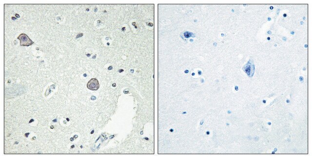 Anti-DRD1 antibody produced in rabbit affinity isolated antibody