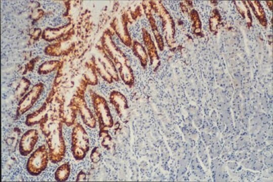 Anti-Mucin-MUC5AC-Antikörper, Klon CLH2 clone CLH2, Chemicon&#174;, from mouse