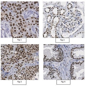 Anti-CtBP-2 Antibody from rabbit, purified by affinity chromatography