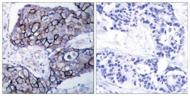 Anti-Integrin &#946;3 antibody produced in rabbit affinity isolated antibody