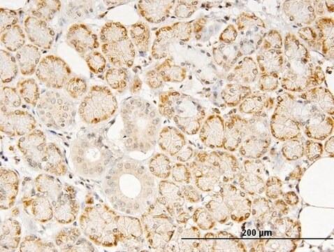 Monoclonal Anti-TNF antibody produced in mouse clone M1-C4, purified immunoglobulin, buffered aqueous solution