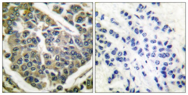 AntykolagenIV affinity isolated antibody