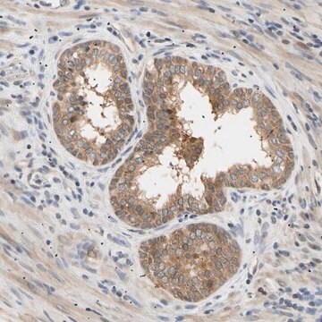 抗SEC23B ウサギ宿主抗体 Prestige Antibodies&#174; Powered by Atlas Antibodies, affinity isolated antibody, buffered aqueous glycerol solution