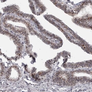 Anti-PSMB2 antibody produced in rabbit Prestige Antibodies&#174; Powered by Atlas Antibodies, affinity isolated antibody, buffered aqueous glycerol solution, Ab2