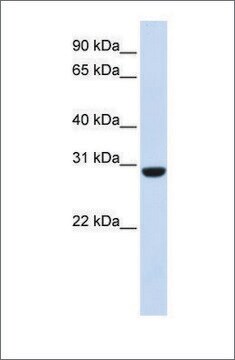 抗RCAN1 affinity isolated antibody