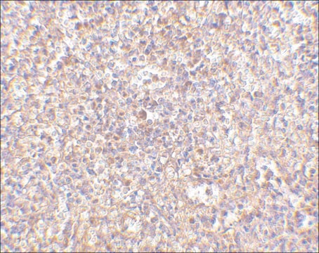 Anti-STEAP1 (ab1) antibody produced in rabbit affinity isolated antibody, buffered aqueous solution