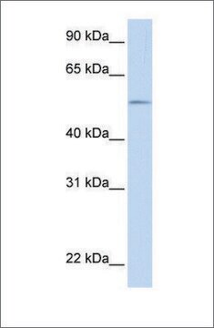 Anti-UGT1A1 affinity isolated antibody