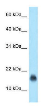 Anti-JCHAIN (N-terminal) antibody produced in rabbit affinity isolated antibody